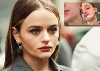 U bë kuzhiniere për një ditë, aktorja e njohur djeg fytyrën