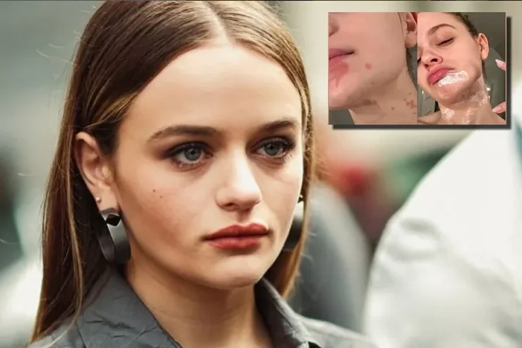 U bë kuzhiniere për një ditë, aktorja e njohur djeg fytyrën