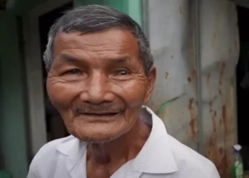 Njihuni me fermerin që pretendon se nuk ka fjetur që prej 1963