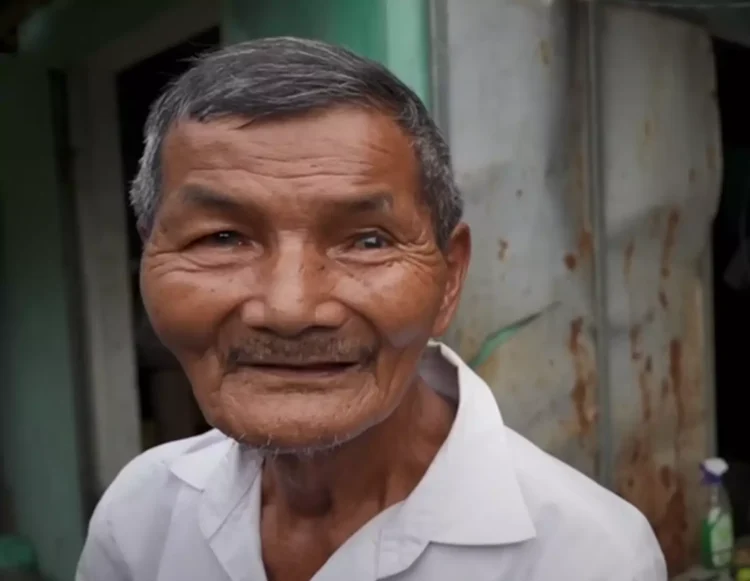 Njihuni me fermerin që pretendon se nuk ka fjetur që prej 1963