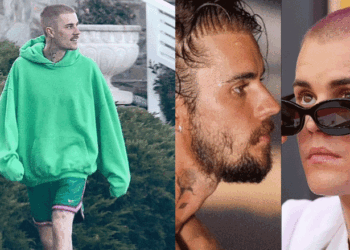 Mes thashethemeve për transplantin e flokëve, Justin bën veprimin e papritur