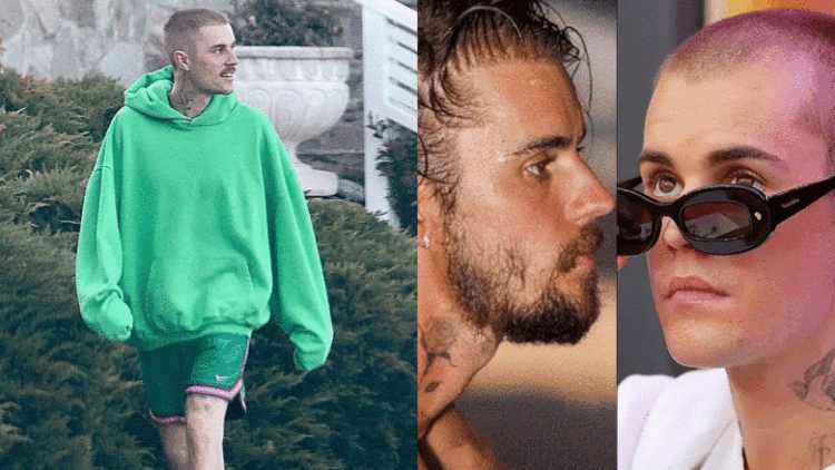 Mes thashethemeve për transplantin e flokëve, Justin bën veprimin e papritur