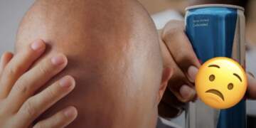 Lëngjet energjike&pijet e gazuara rrisin rënien e flokëve dhe ankthin te meshkujt