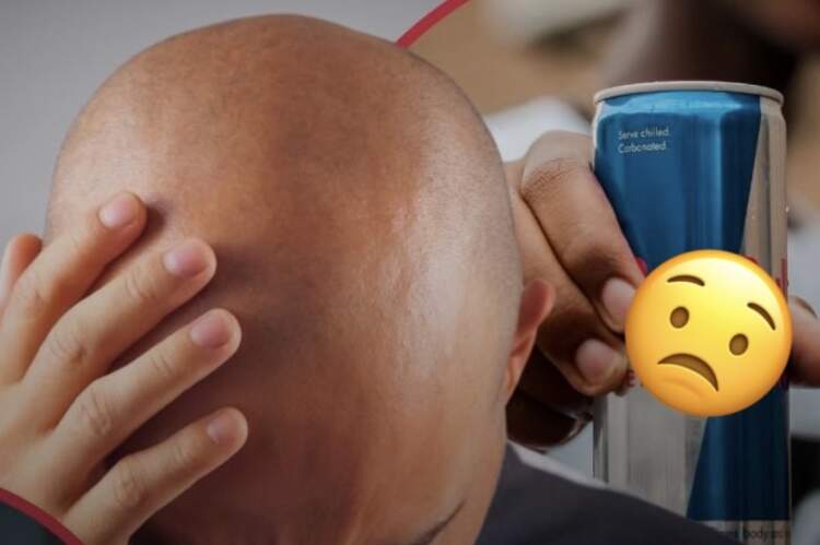 Lëngjet energjike&pijet e gazuara rrisin rënien e flokëve dhe ankthin te meshkujt