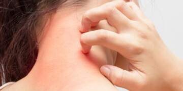 Aplikacioni i ri me AI ndihmon në zbulimin e kancerit të lëkurës në fazat e hershme