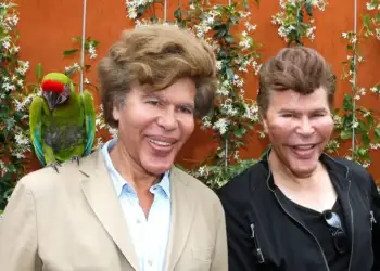 Binjakët Bogdanoff: Histori e kirurgjisë plastike, mashtrimit dhe vetëvrasjes