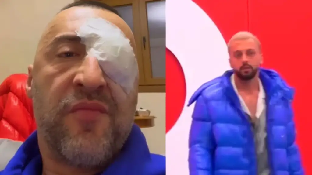 G-Bani i përlotur mbështet Gjestin: “Nuk e meritoje këtë, kam bërë gabim”