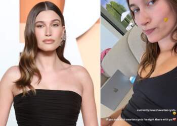 Hailey ndan shqetësimin shëndetësor: Dy kiste në vezore