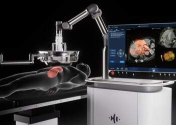 Shpresë! Trajtimi i ri me histotripsi: Vret qelizat e kancerit me tinguj dhe ujë