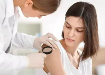 Melanoma: 6 ndryshime të dyshimta në nishane që nuk duhet t’i injorojmë