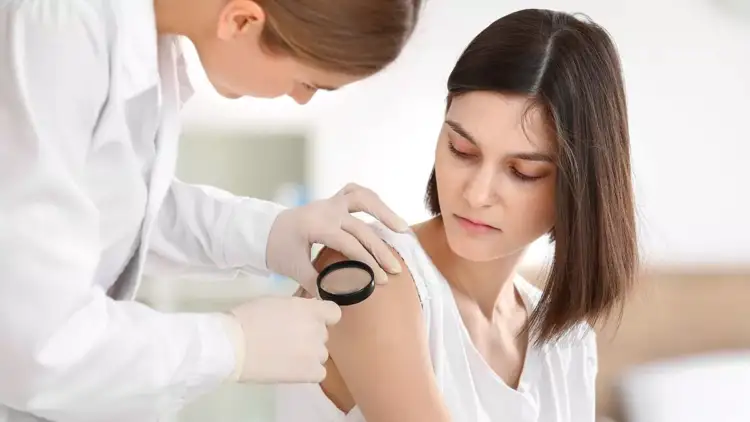 Melanoma: 6 ndryshime të dyshimta në nishane që nuk duhet t’i injorojmë