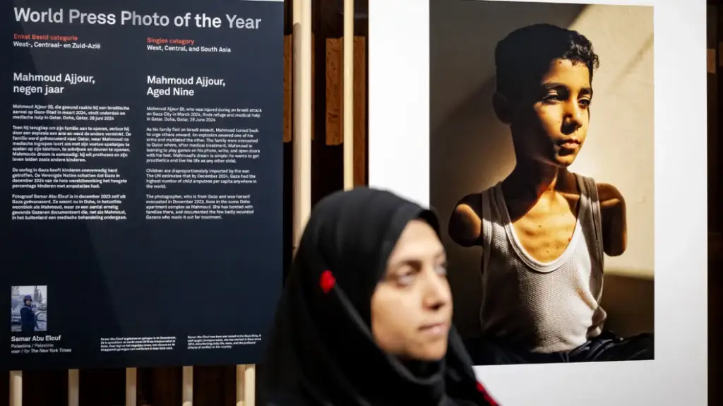 World Press Photo: Çmimi i parë për foton e palestinezit të amputuar në të dy krahët