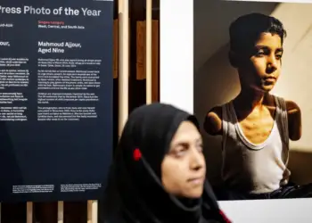 World Press Photo: Çmimi i parë për foton e palestinezit të amputuar në të dy krahët