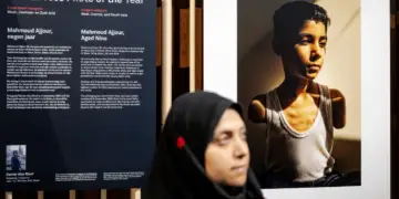 World Press Photo: Çmimi i parë për foton e palestinezit të amputuar në të dy krahët