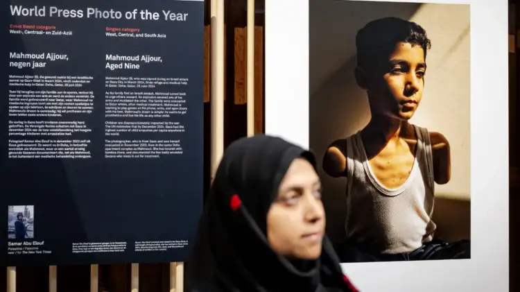 World Press Photo: Çmimi i parë për foton e palestinezit të amputuar në të dy krahët