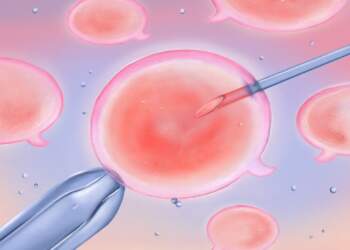 Çfarë duhet thënë dhe çfarë jo miqve ose kolegëve që bëjnë fertilizim in vitro