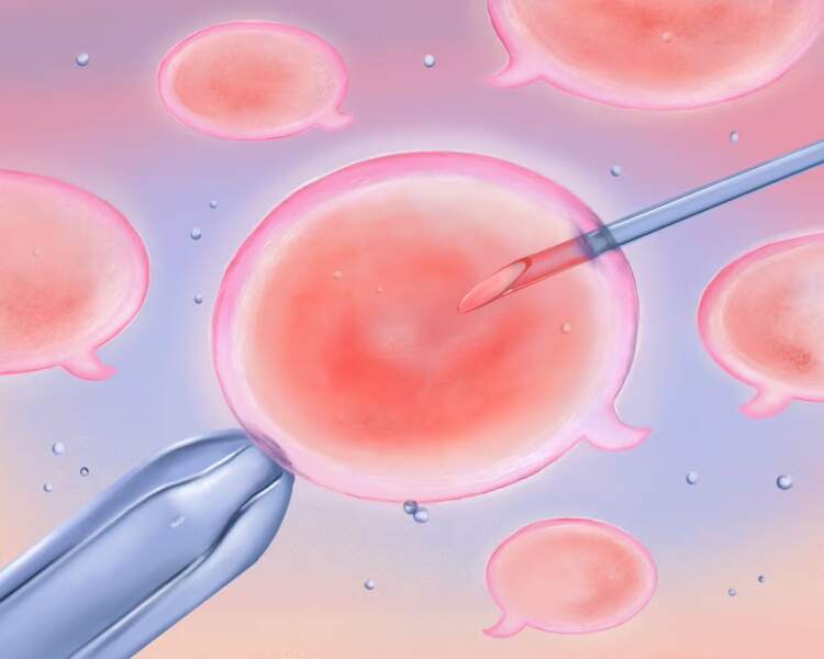 Çfarë duhet thënë dhe çfarë jo miqve ose kolegëve që bëjnë fertilizim in vitro