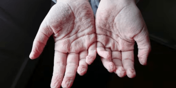 Ja arsyeja e vërtetë pse gishtat rrudhen në ujë