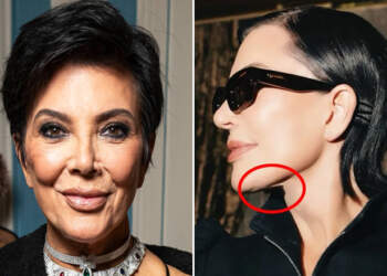 Kris Jenner ngjall reagime pas pamjes së re: Ndjekësit vënë në pikëpyetje natyrshmërinë e fytyrës së saj