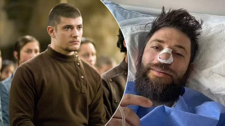 Çfarë ndodhi? Viktor Krum i “Harry Potter” përfundon në spital