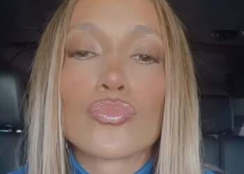 Jennifer Lopez shfaqet me filtra të rëndë pas dëmtimit në hundë, fansat nisin të shqetësohen