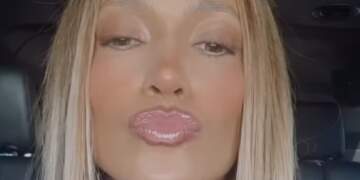 Jennifer Lopez shfaqet me filtra të rëndë pas dëmtimit në hundë, fansat nisin të shqetësohen