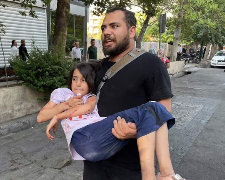 “Ishte një kasaphanë”! Mjekët në Iran po luftojnë për jetë mes kaosit të luftës me Izraelin