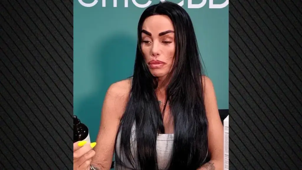 Fansat e Katie Price janë të shokuar: Ndalo kirurgjinë plastike tani