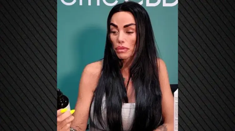 Fansat e Katie Price janë të shokuar: Ndalo kirurgjinë plastike tani