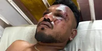 Pasagjeri në sediljen 11A/ Ky është i mbijetuari i vetëm i tragjedisë së avionit në Indi