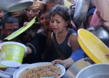 Një në 10 fëmijë në Gaza është i kequshqyer dhe shifrat vazhdojnë të rriten