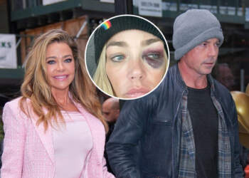 Denise Richards merr urdhër mbrojtjeje ndaj bashkëshortit: Më ka goditur dhe më ka zënë për fyti