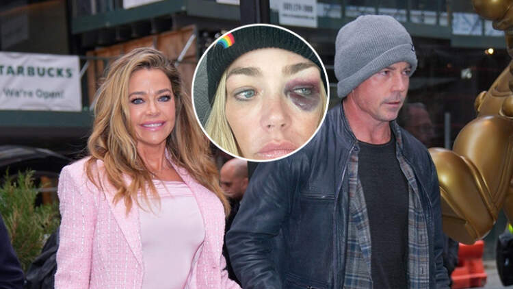 Denise Richards merr urdhër mbrojtjeje ndaj bashkëshortit: Më ka goditur dhe më ka zënë për fyti