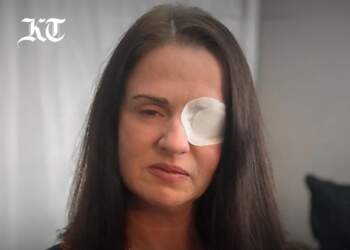 Skandal në industrinë e bukurisë në Britaninë e Madhe: Gruaja mbetet pjesërisht e verbër nga Botoxi