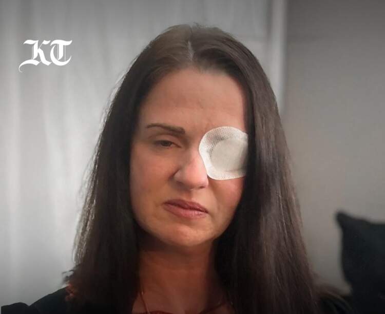 Skandal në industrinë e bukurisë në Britaninë e Madhe: Gruaja mbetet pjesërisht e verbër nga Botoxi