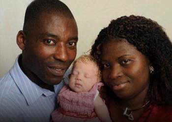 Kur fëmija nuk i ngjan prindërve: rasti i pazakontë nga Londra