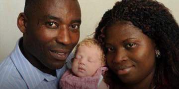 Kur fëmija nuk i ngjan prindërve: rasti i pazakontë nga Londra