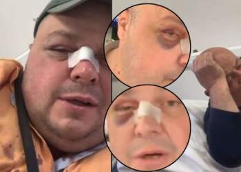 Dhunoi Genard Hajdinin dhe babanë e tij, nis hetimi për autorin dhe 25-vjeçaren