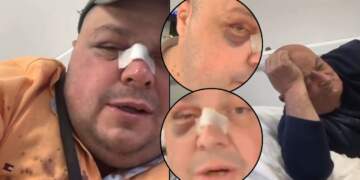 Dhunoi Genard Hajdinin dhe babanë e tij, nis hetimi për autorin dhe 25-vjeçaren