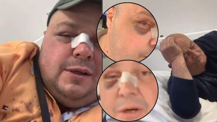 Dhunoi Genard Hajdinin dhe babanë e tij, nis hetimi për autorin dhe 25-vjeçaren