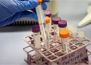 Arsyet për shpresë në luftën kundër diabetit: shkencëtarët zbulojnë një mënyrë për të ulur nivelin e sheqerit në gjak