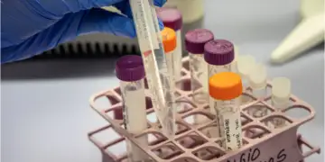 Arsyet për shpresë në luftën kundër diabetit: shkencëtarët zbulojnë një mënyrë për të ulur nivelin e sheqerit në gjak