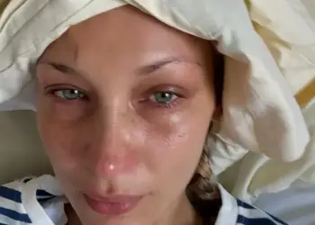 Si është gjendja e saj? Bella Hadid poston foto alarmante nga shtrati i spitalit