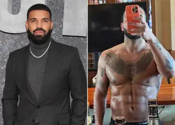 Ka bërë ndërhyrje plastike në trupin e tij? Flet për herë të parë Drake