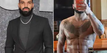 Ka bërë ndërhyrje plastike në trupin e tij? Flet për herë të parë Drake