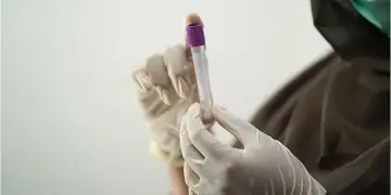 Grupi i gjakut dhe lidhja e tij me rrezikun e goditjes në tru: çfarë zbulon një studim i ri gjenetik