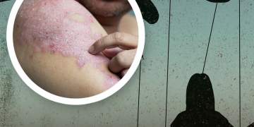 Studimet tregojnë: Të thuash ‘Po’ shumë shpesh mund të çojë në sëmundje autoimune