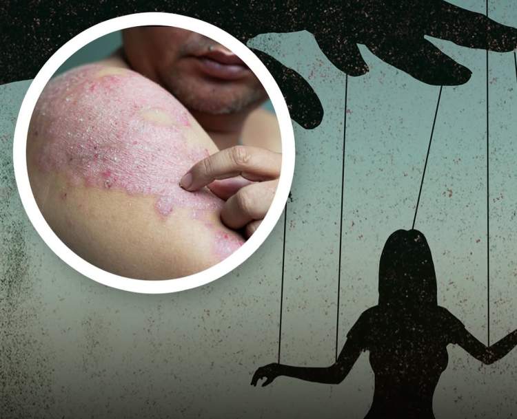 Studimet tregojnë: Të thuash ‘Po’ shumë shpesh mund të çojë në sëmundje autoimune