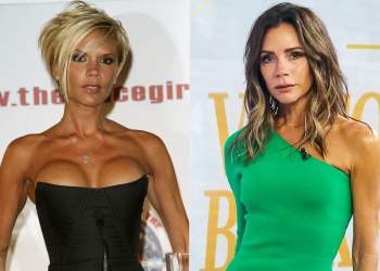 Victoria Beckham zbulon sekretin e transformimit të saj: Pse hoqi implantet e gjoksit?