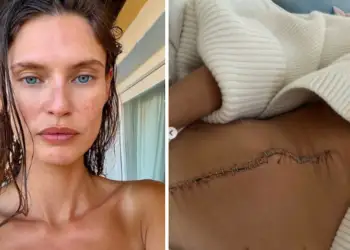 Victoria’s Secret e refuzoi sepse ka kancer: letra prekëse e Bianca Balti që tronditi botën e modës
